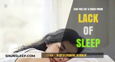 Sleep Deprivation and Skin: Can Lack of Sleep Cause Rashes?