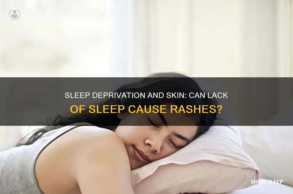 can you get a rash from lack of sleep