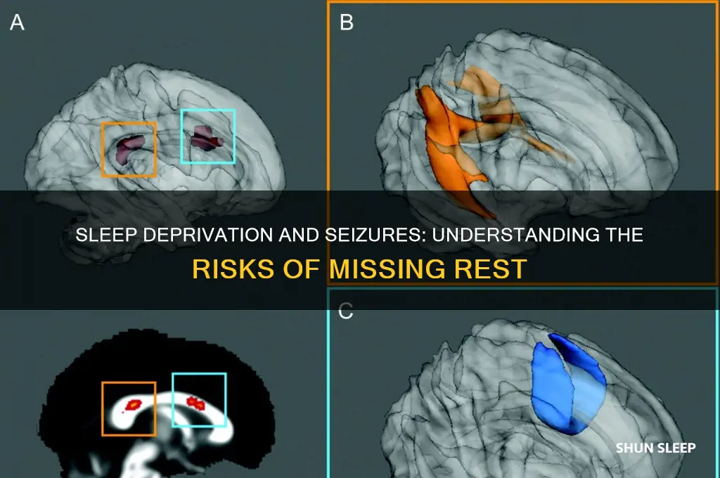 can you get a seizure from lack of sleep