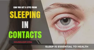Sleeping in Contacts: Risks and Link to Developing a Stye
