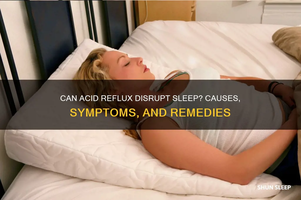 can you get acid reflux in your sleep
