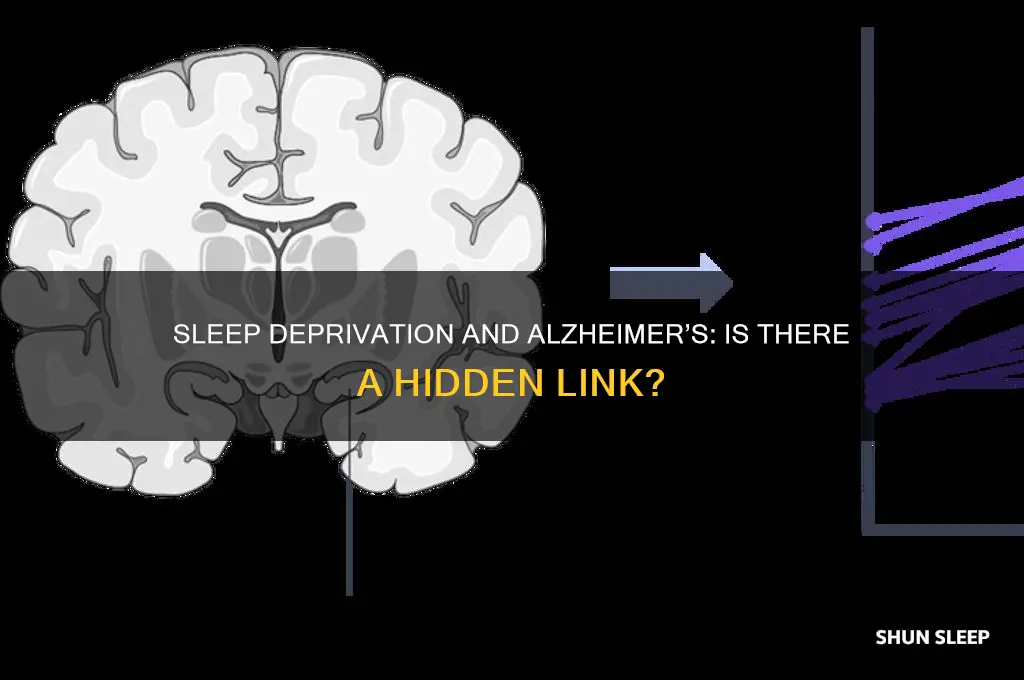 can you get alzheiners if you dont sleep ebough