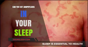 Can You Experience Anaphylaxis While Sleeping? Understanding Nighttime Allergic Reactions