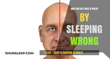 Sleeping Wrong and Bell's Palsy: Unraveling the Myth and Facts