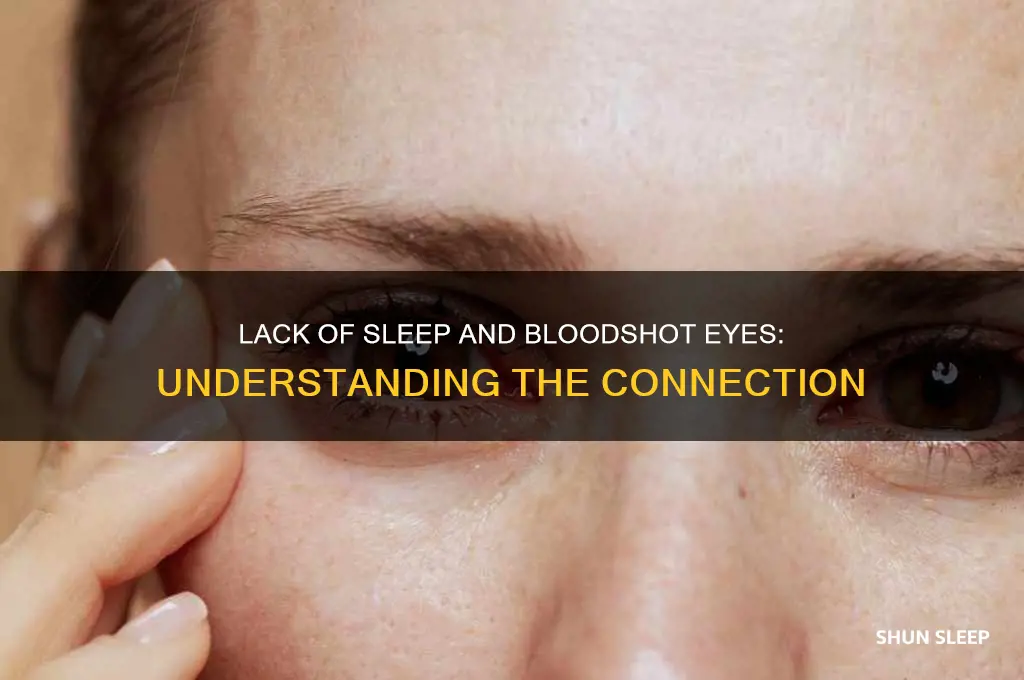 can you get bloodshot eyes from lack of sleep