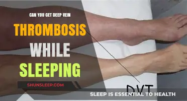 Can You Develop Deep Vein Thrombosis During Sleep? Facts Revealed