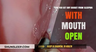 Sleeping with Mouth Open: Dry Socket Risks and Prevention Tips