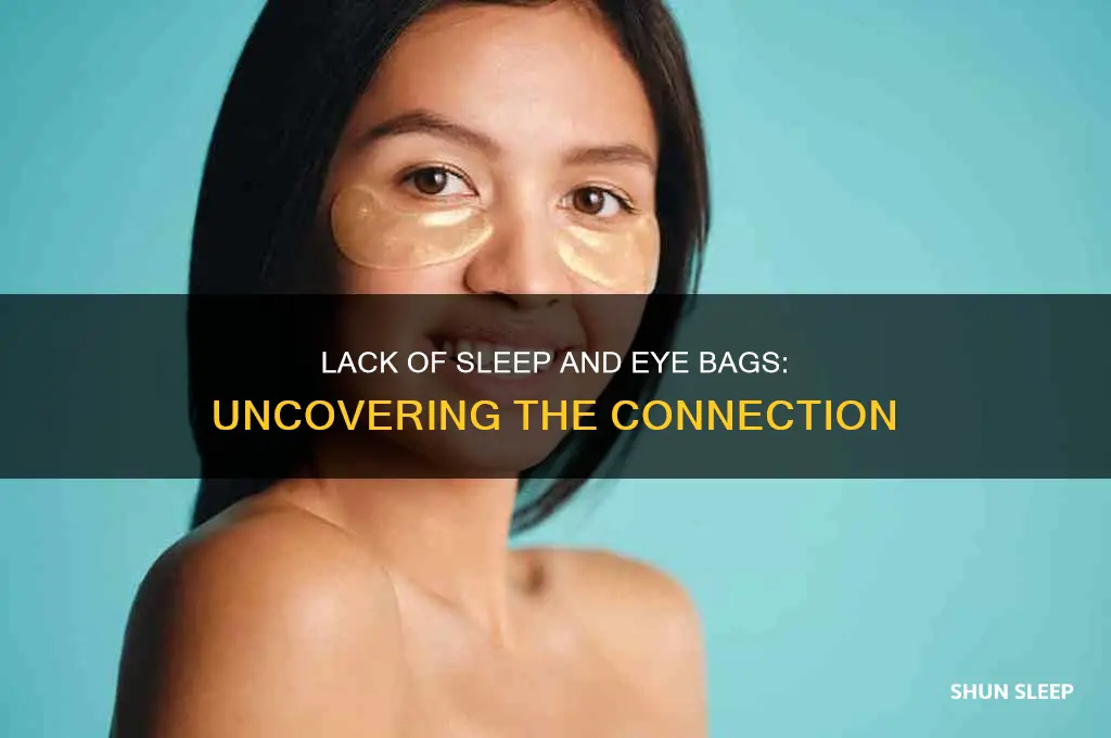 can you get eye bags from not sleeping