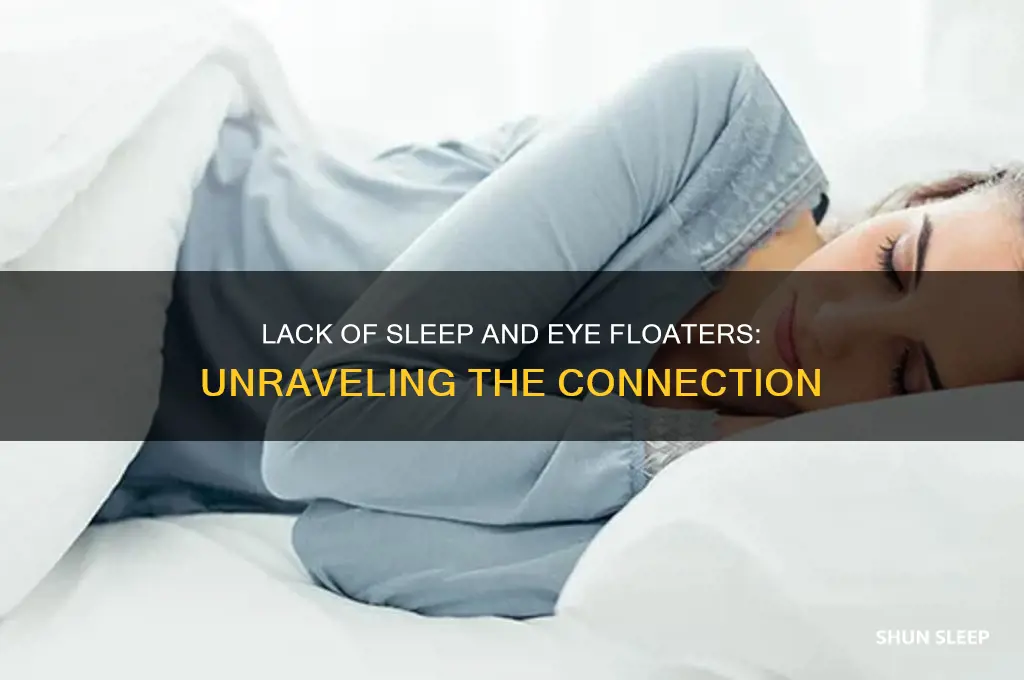 can you get eye floaters from lack of sleep