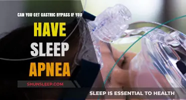 Sleep Apnea and Gastric Bypass: Eligibility, Risks, and Benefits Explained