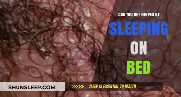 Sleeping on a Shared Bed: Herpes Transmission Risks Explained