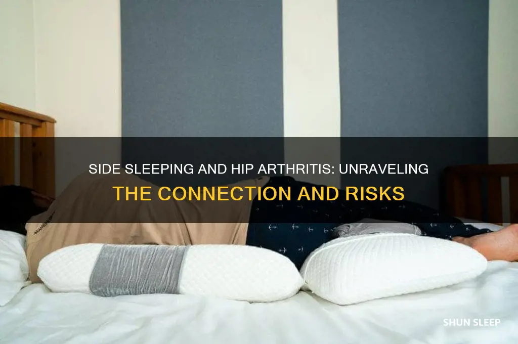 can you get hip arthritis from sleeping on your side