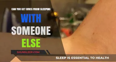 Can Sharing a Bed Cause Hives? Exploring Allergic Reactions to Partners