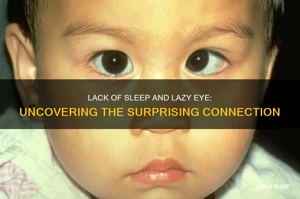can you get lazy eye from lack of sleep