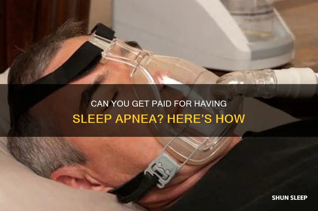 can you get money for having sleep apnea