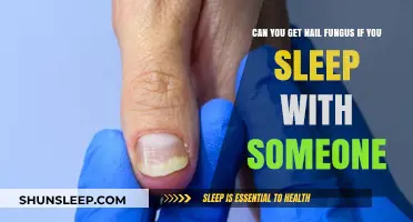 Sleeping with a Partner: Nail Fungus Risks and Prevention Tips