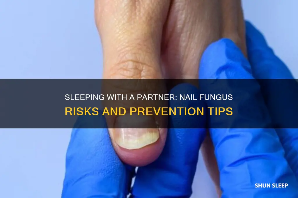 can you get nail fungus if you sleep with someone