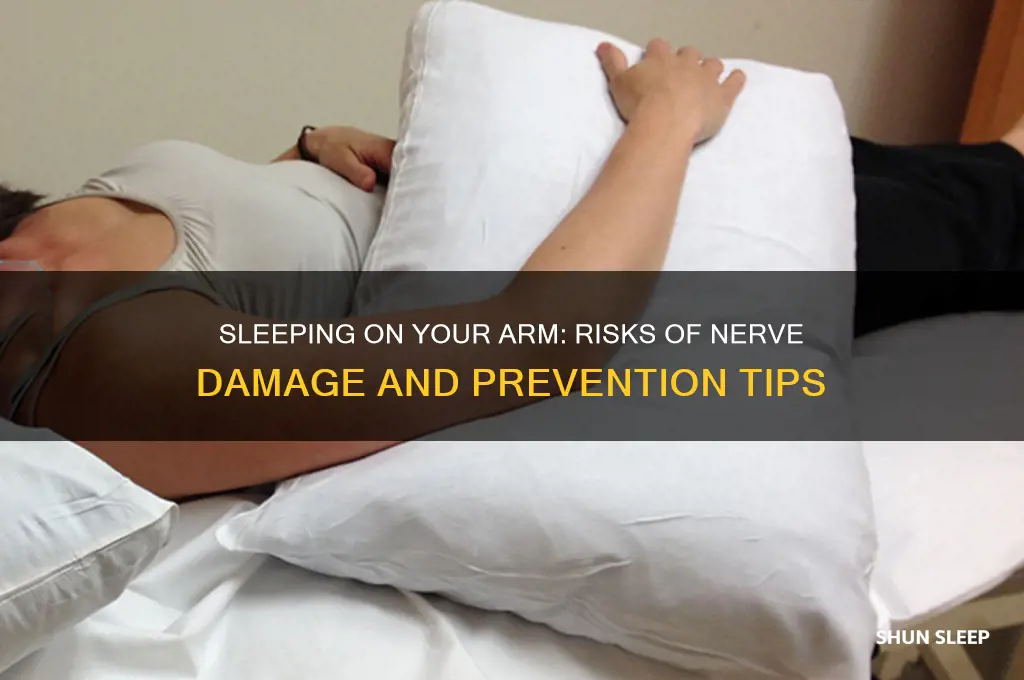 can you get nerve damage from sleeping on your arm