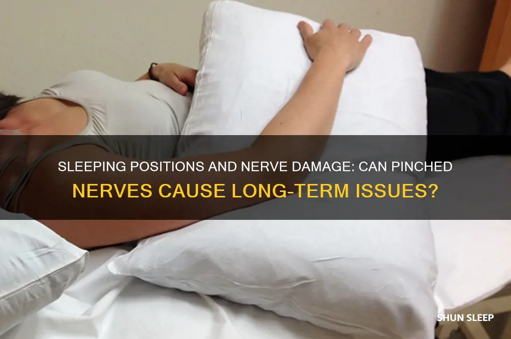 can you get nerve damage from sleeping pinching a nerve