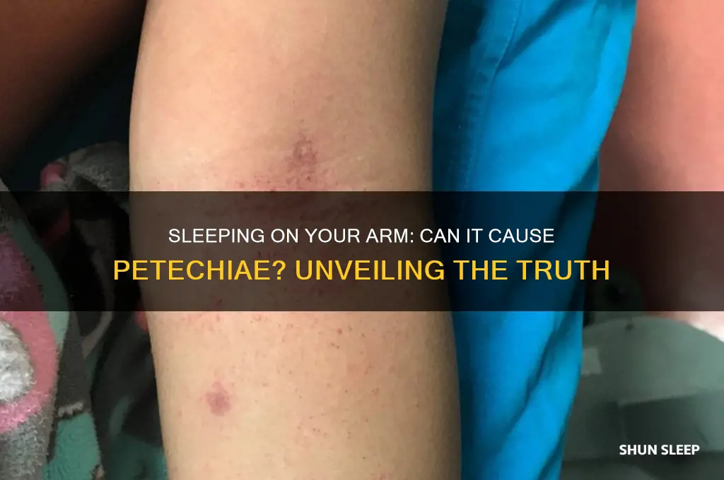 can you get petechiae from sleeping on your arm