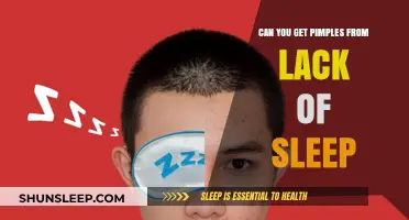Lack of Sleep and Pimples: Uncovering the Surprising Skin Connection