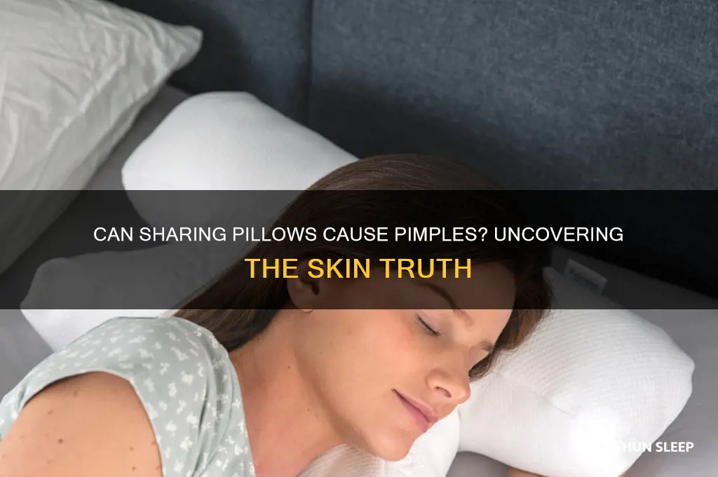 can you get pimples from sleeping on someone else