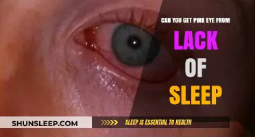 Lack of Sleep and Pink Eye: Unraveling the Connection
