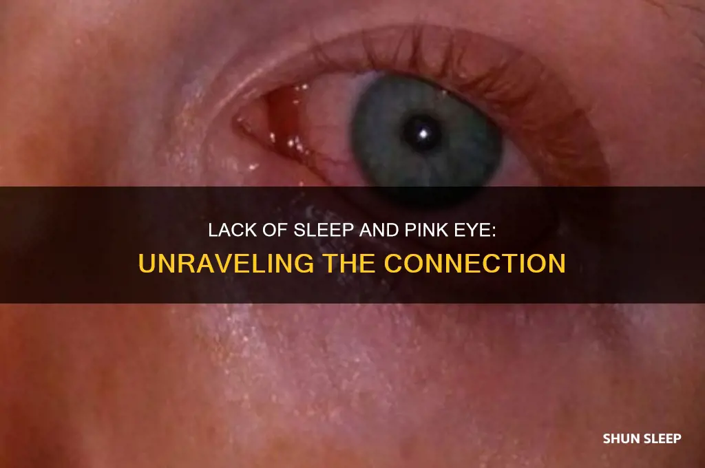 can you get pink eye from lack of sleep