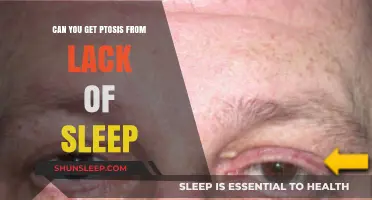 Lack of Sleep and Ptosis: Uncovering the Surprising Connection