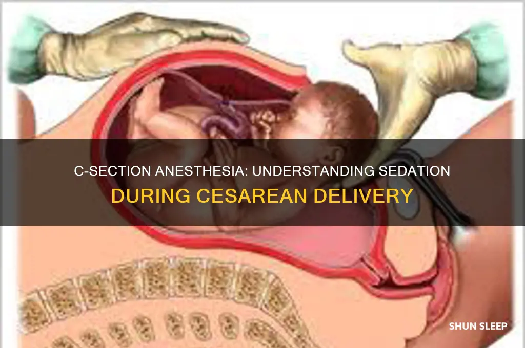 can you get put to sleep during a c section