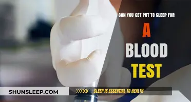 Blood Tests and Sedation: Understanding Anesthesia Options for Patients