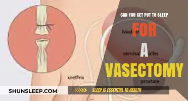 Vasectomy Under Anesthesia: Exploring Sedation Options for the Procedure