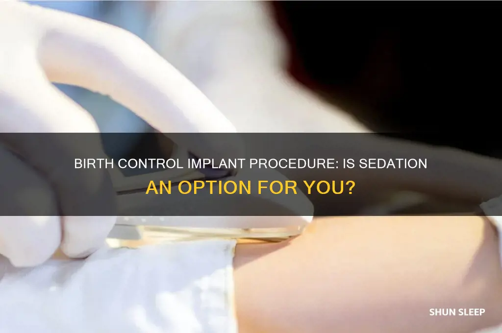 can you get put to sleep for birth control implantatio