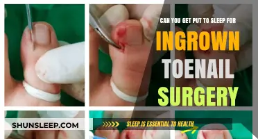 Ingrown Toenail Surgery: Will You Need Anesthesia for the Procedure?