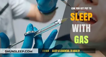 Can You Be Put to Sleep with Gas? Exploring Anesthesia Methods