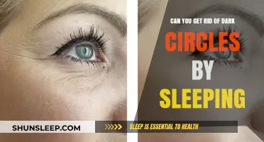 Sleep and Dark Circles: Can Rest Really Brighten Your Under-Eyes?