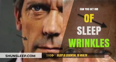 Can You Get Rid of Sleep Wrinkles? Effective Solutions Revealed