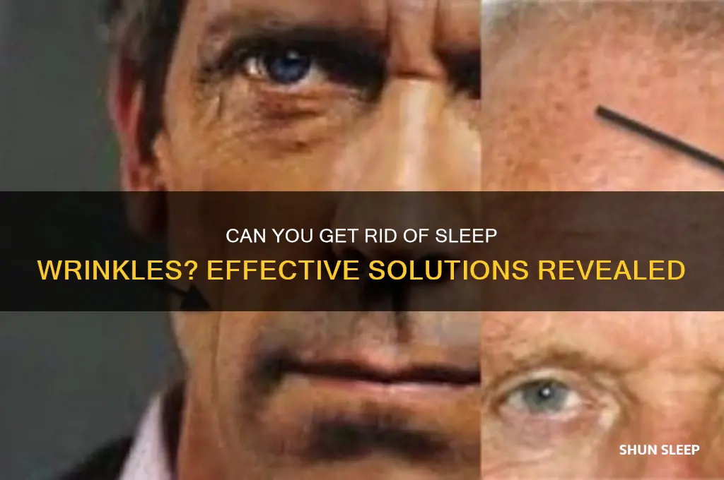 can you get rid of sleep wrinkles