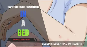 Can You Catch Scabies from Sleeping in a Bed?