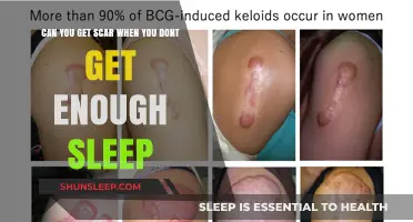 Sleep Deprivation and Skin Health: Can Lack of Sleep Cause Scars?