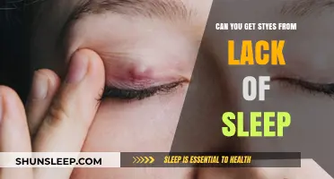 Lack of Sleep and Styes: Unraveling the Surprising Connection