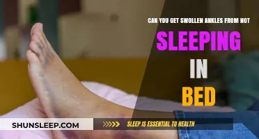 Lack of Sleep in Bed: A Cause for Swollen Ankles?
