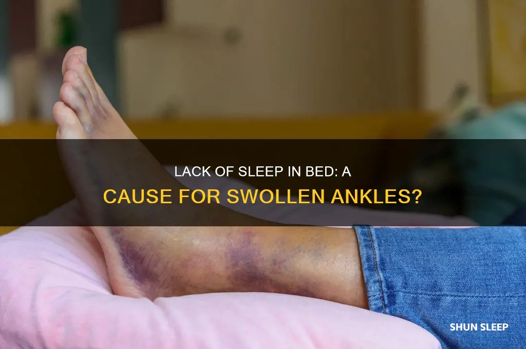 can you get swollen ankles from not sleeping in bed