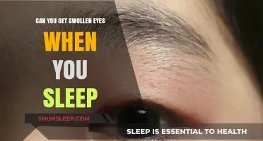 Why Do Eyes Swell After Sleep? Causes and Quick Remedies