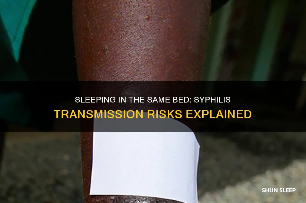 can you get syphilis by sleeping in the same bed