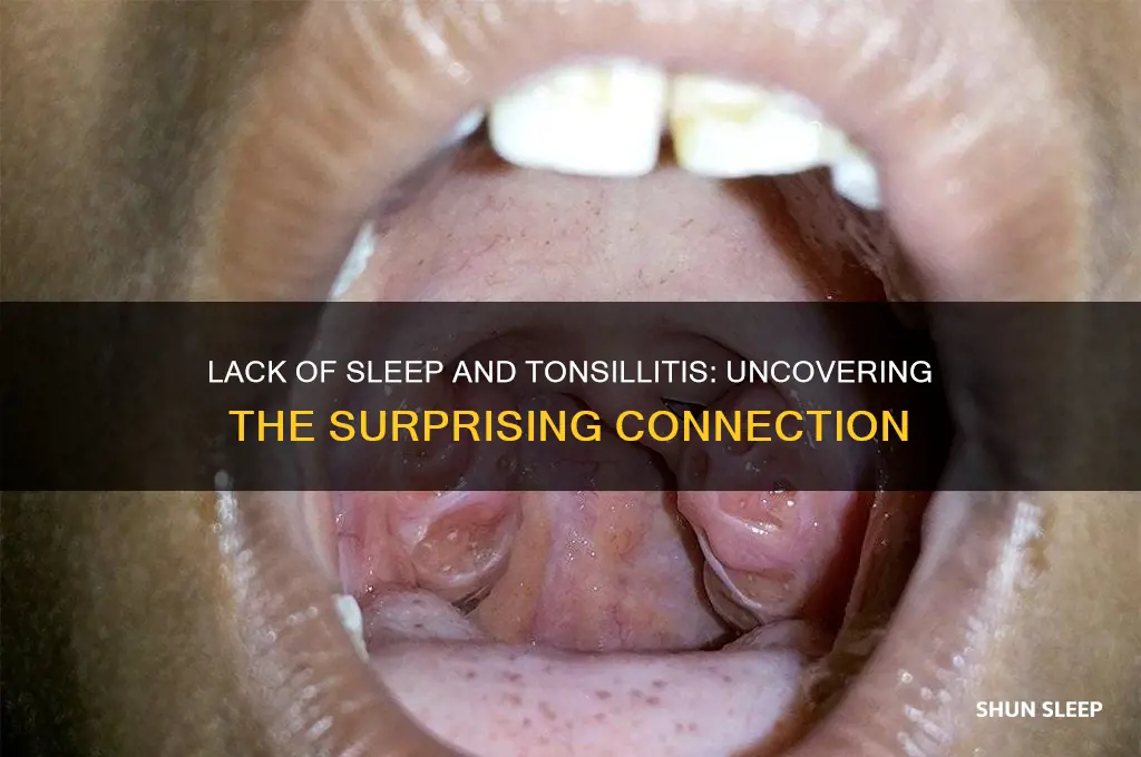 can you get tonsillitis from lack of sleep