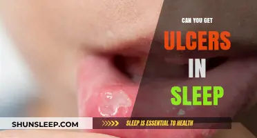Can You Develop Ulcers While Sleeping? Uncovering the Surprising Truth