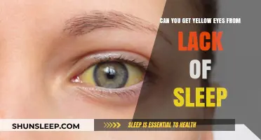 Lack of Sleep and Yellow Eyes: Uncovering the Surprising Connection