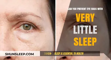 Sleep Less, Look Tired: Preventing Eye Bags