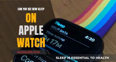 Apple Watch: Tracking Your REM Sleep